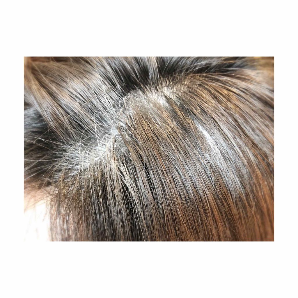 ドライ シャンプー/スティーブンノル ニューヨーク/ドライシャンプーを使ったクチコミ（3枚目）