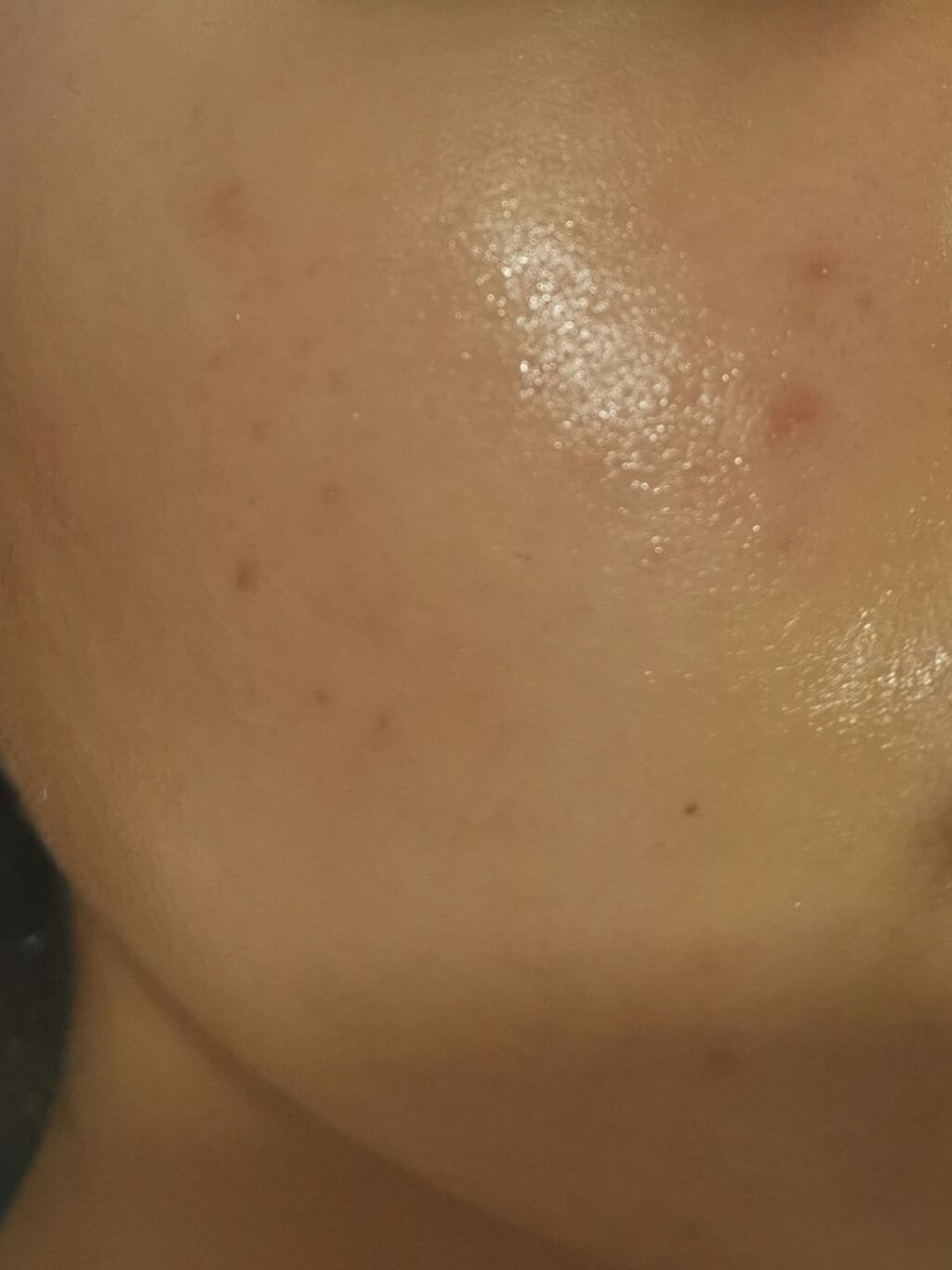 DHC ビタミンＣハードカプセル/DHC/美容サプリメントを使ったクチコミ（3枚目）