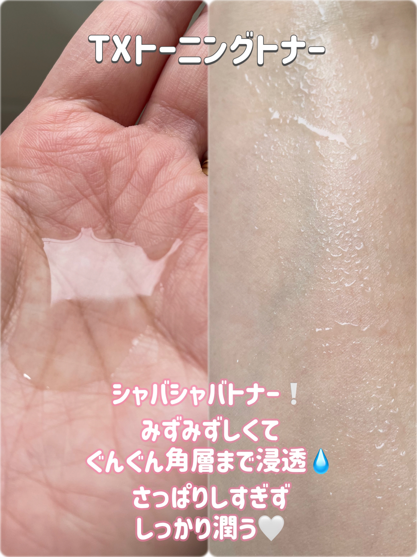 S300 リードル/VT/美容液を使ったクチコミ（3枚目）