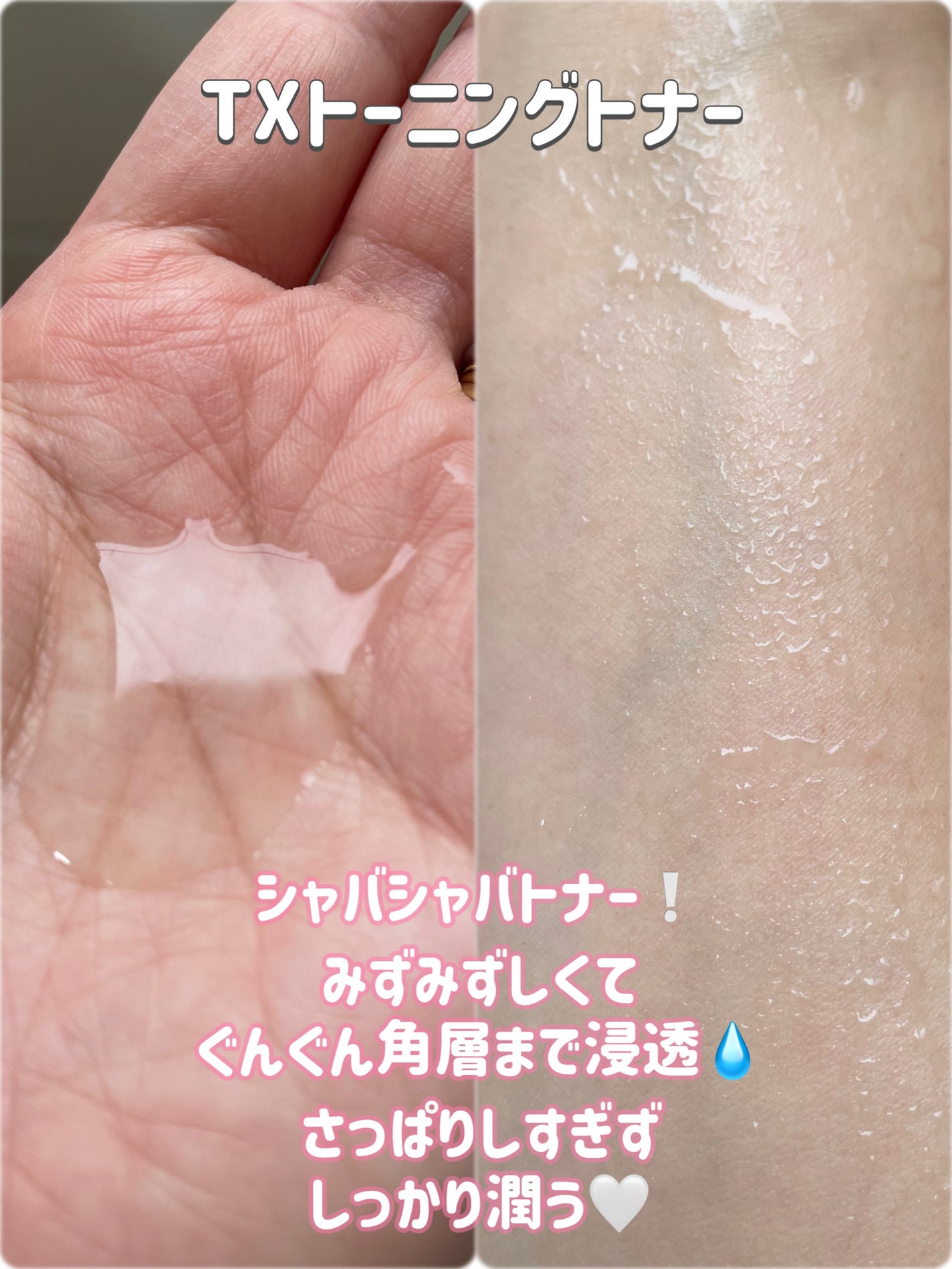 S300 リードル/VT/美容液を使ったクチコミ(3枚目)