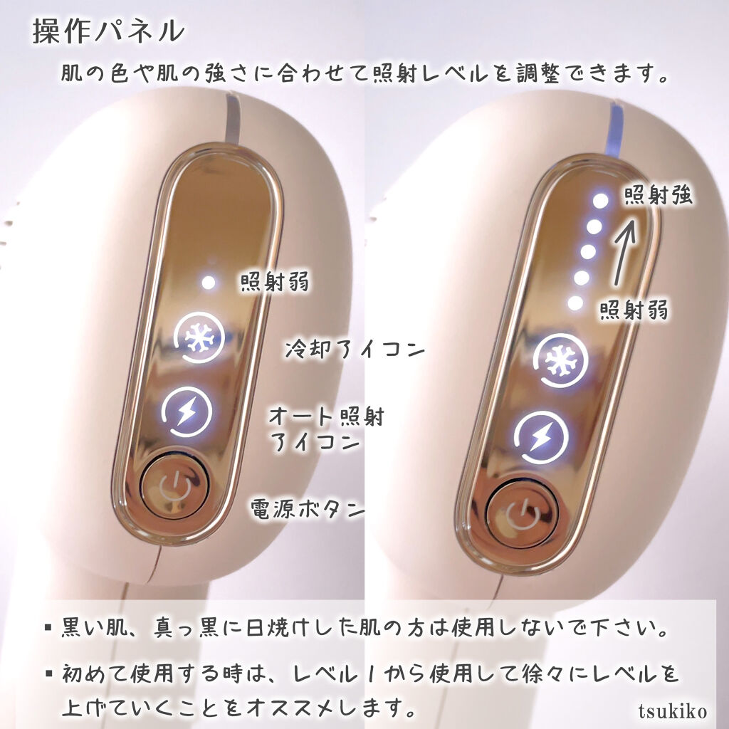 サファイアIPL脱毛器 ｜yeteの口コミ - beautigo 零度・サファイア脱毛