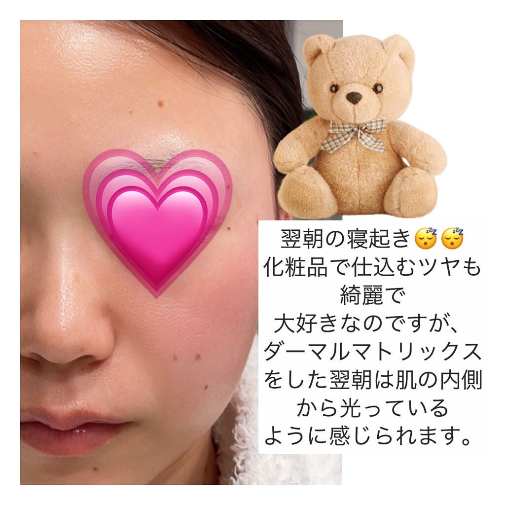 フェイシャルダーマルケアマスク Dermall matrix/Dermall matrix/シートマスク・パックを使ったクチコミ(4枚目)