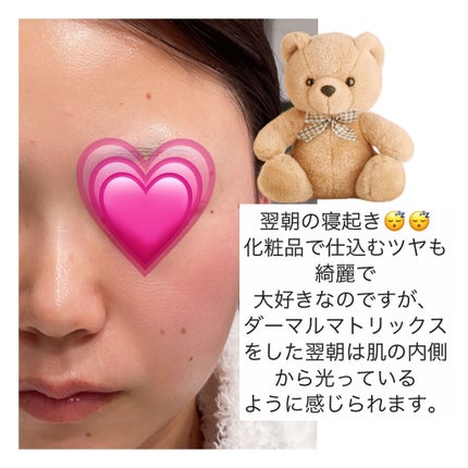 フェイシャルダーマルケアマスク Dermall matrix/Dermall matrix/シートマスク・パックを使ったクチコミ(4枚目)