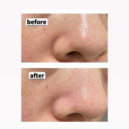 ソーダ洗顔料/manyo/洗顔フォームを使ったクチコミ(5枚目)