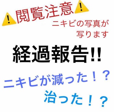  D濃密美容液 ヒアルロン酸/DAISO/美容液を使ったクチコミ（1枚目）