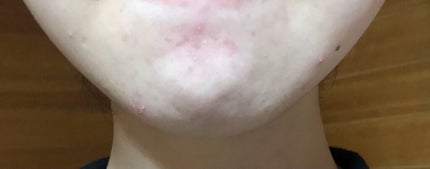 ðNinað on LIPS ãâ ïžæ±è泚æã§ãïŒâ ïžããã«ã¡ã¯ïŒããã°ãã¯ïŒæšæ¥ã¯ãã¹ãå匷..ãïŒ2æç®ïŒ