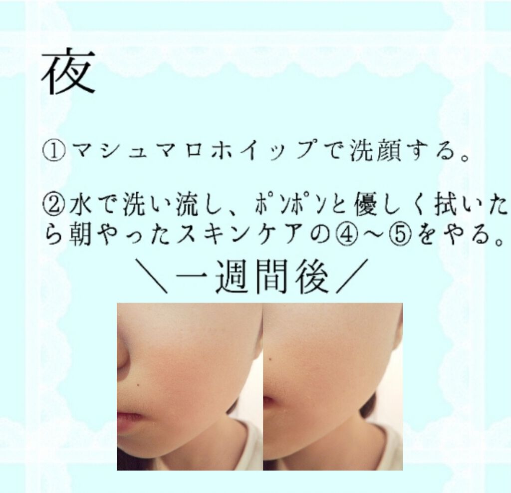 ハトムギ化粧水(ナチュリエ スキンコンディショナー R )/ナチュリエ/化粧水を使ったクチコミ(4枚目)