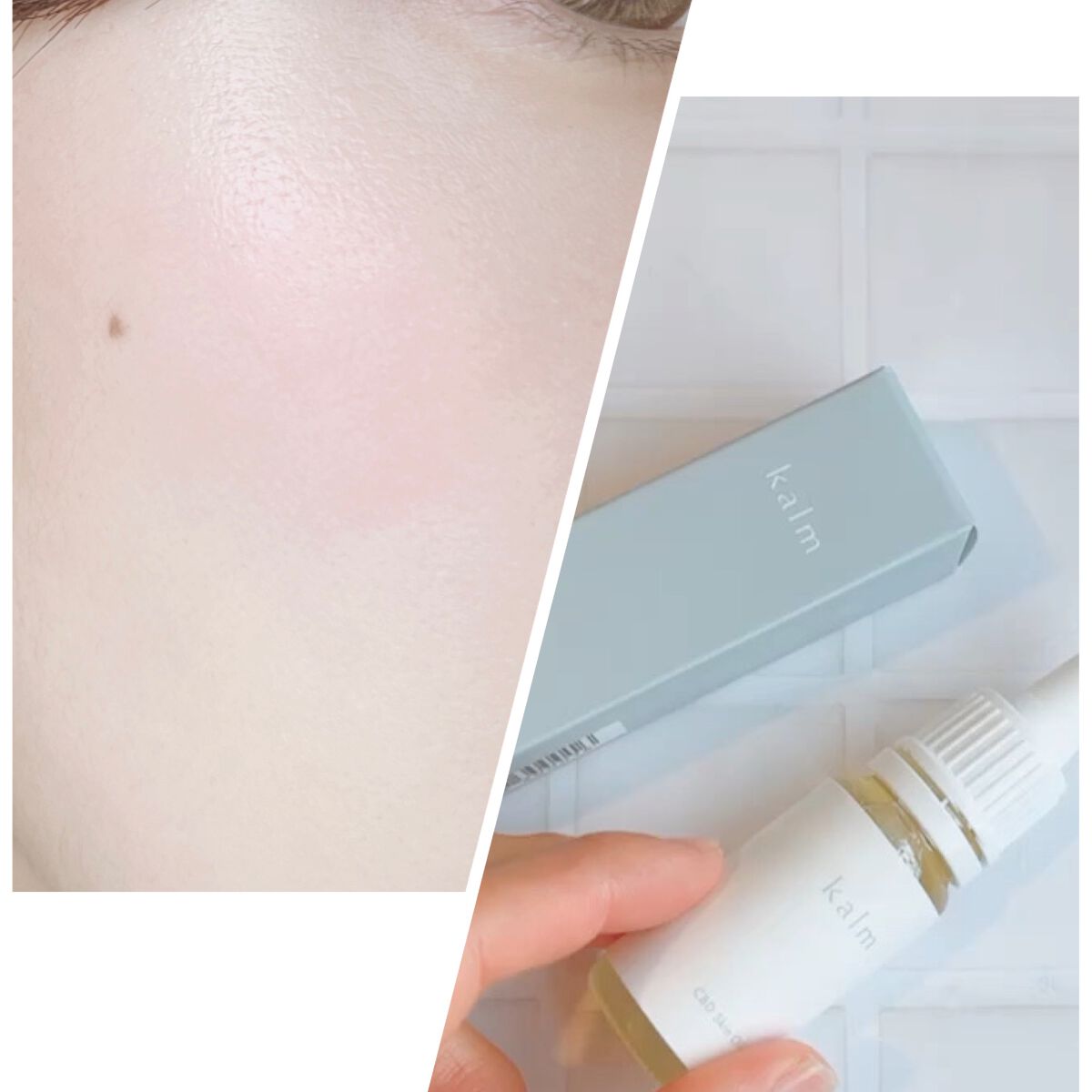 CBDスキンオイル/kalm/フェイスオイルを使ったクチコミ(3枚目)