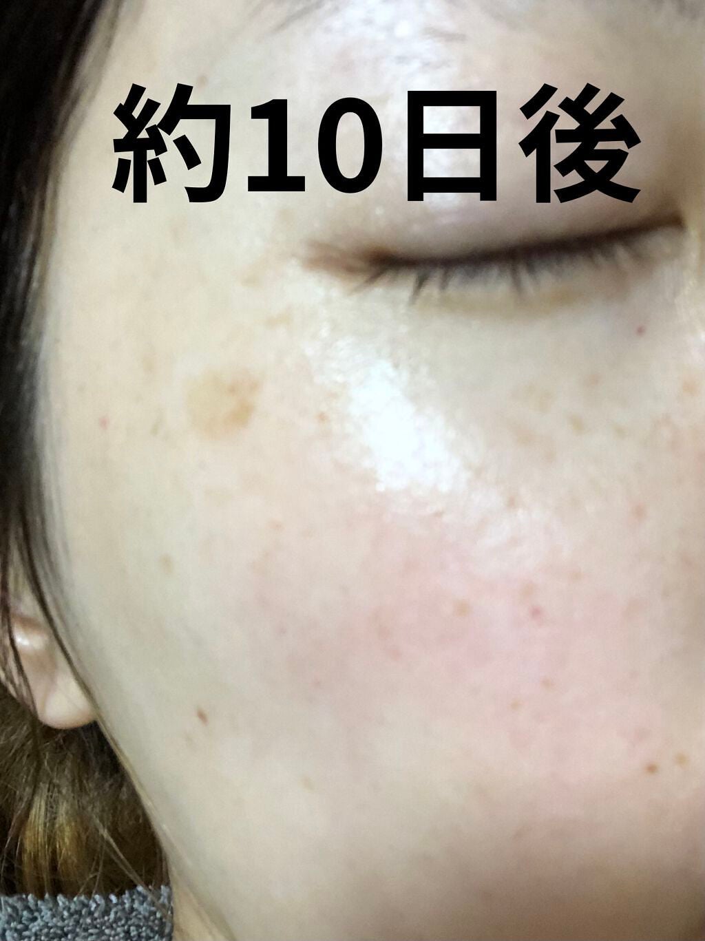 C25セラム ネオ/オバジ/美容液を使ったクチコミ(2枚目)