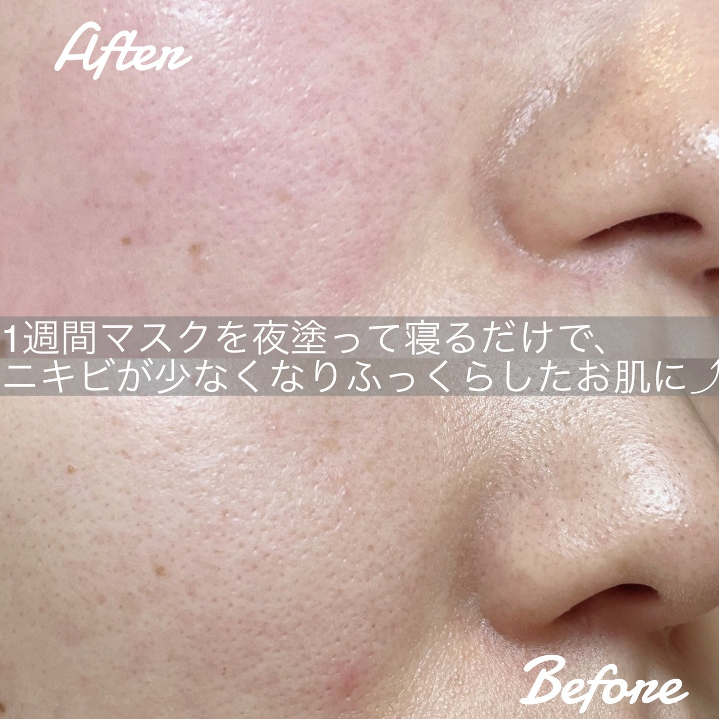 アペックス マスク 921/APEX/フェイスクリームを使ったクチコミ(2枚目)