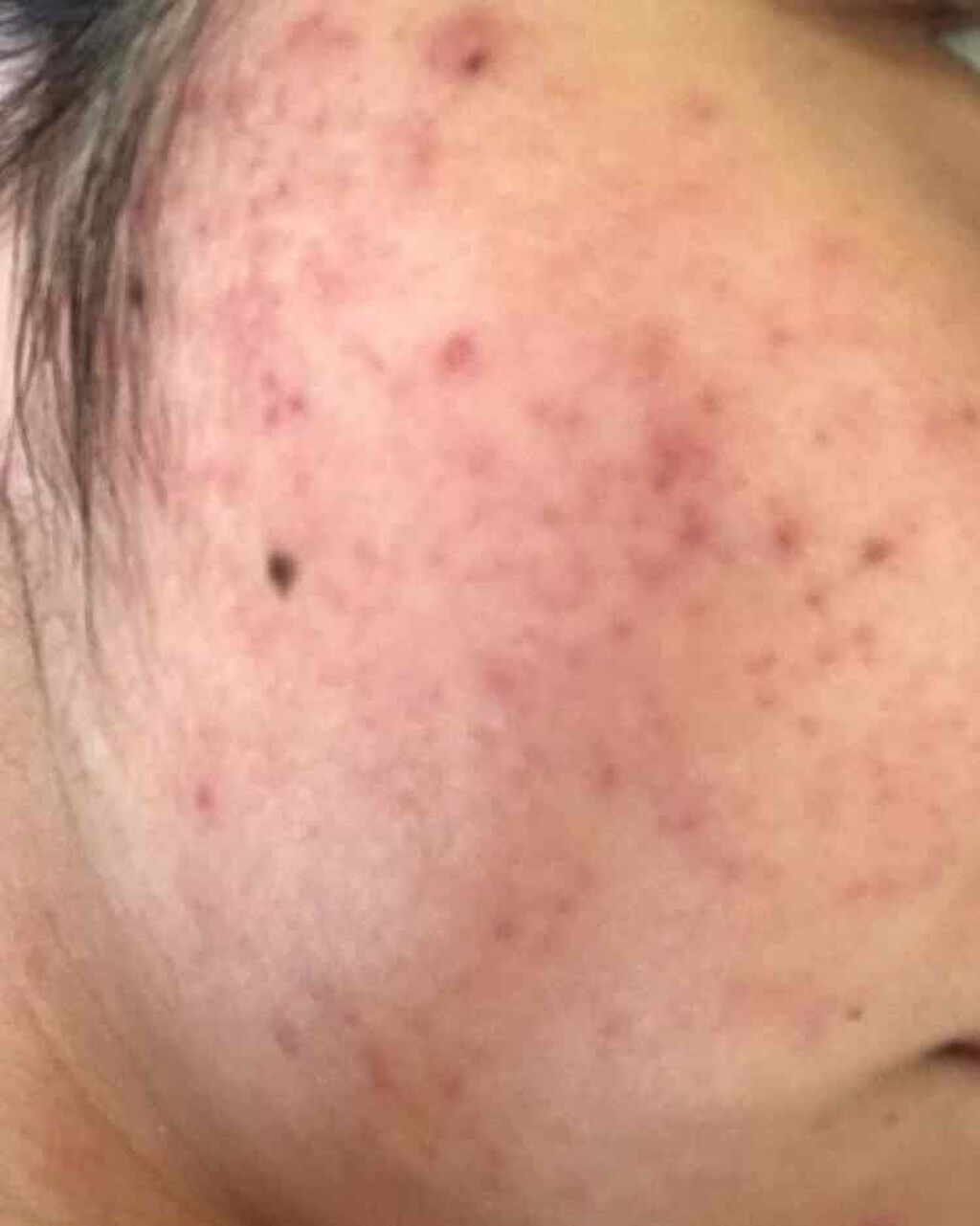 薬用保湿化粧水/オードムーゲ/化粧水を使ったクチコミ(4枚目)