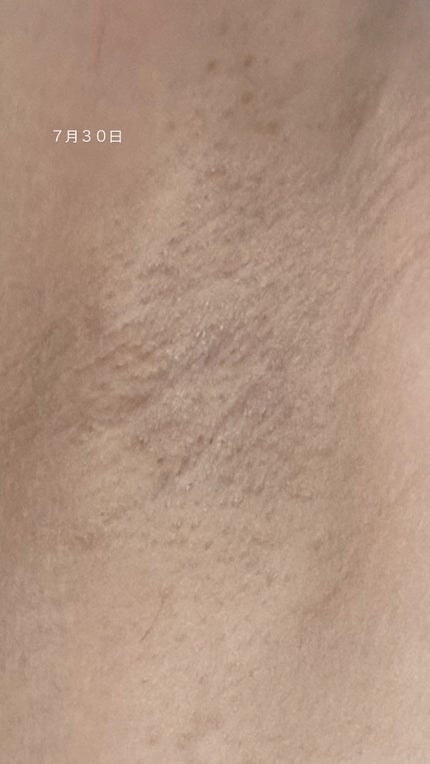 にんげん on LIPS 「脇と胸の黒ずみ、1週間検証してみた結果!時間帯は、夜10時に統..」(4枚目)