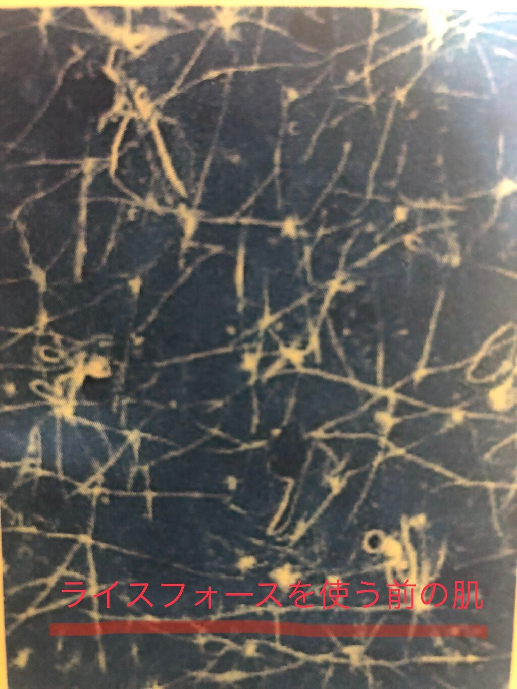 ライスフォース30日セット/ライスフォース/トライアルキットを使ったクチコミ(2枚目)