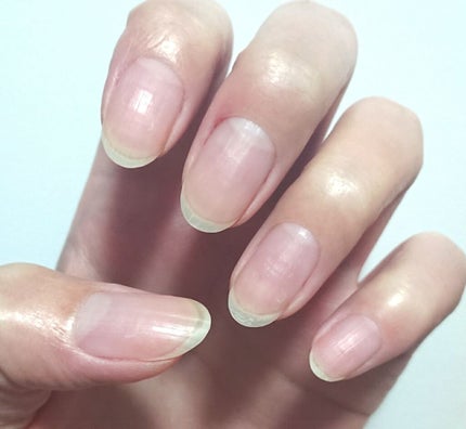 ネイルポリッシュリムーバー EX/D-UP/除光液を使ったクチコミ(2枚目)