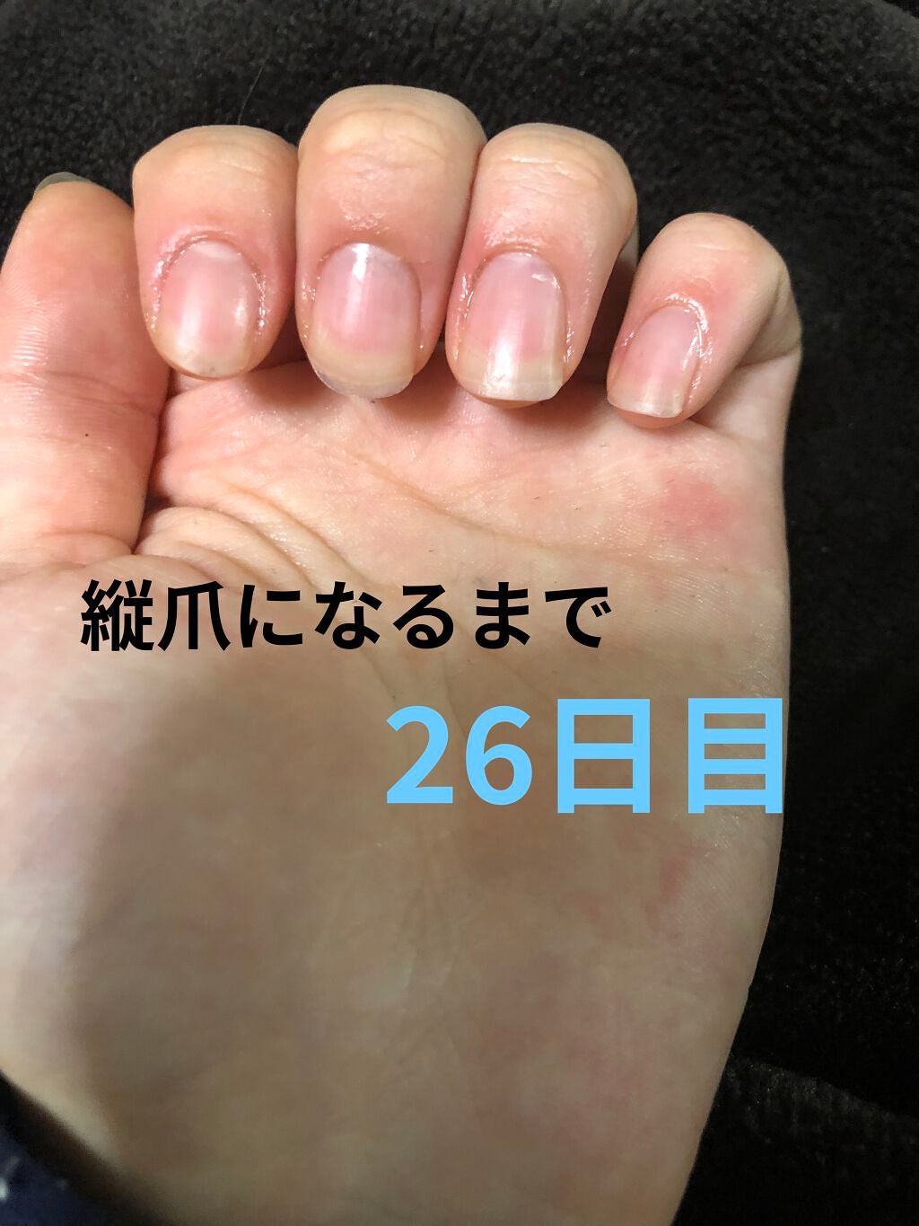 ð on LIPS ã瞊çªã«ãªãããã«ãããããªæ¹æ³ããã£ããæããŠãã ããðããã..ãïŒ1æç®ïŒ