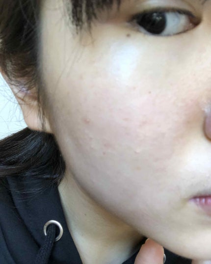 プレシャスミネラル BBクリーム カバー&ブライトフィット/ETUDE/BBクリームを使ったクチコミ(3枚目)