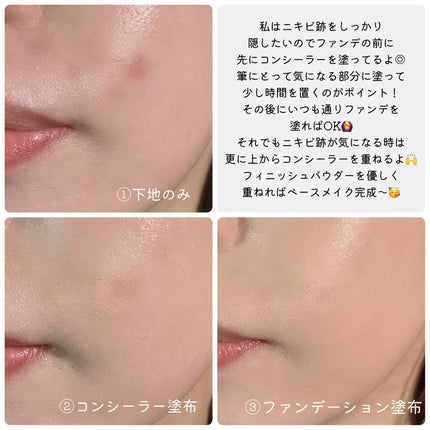 薬用コンシーラー アクネプロテクター/ONLY MINERALS/パウダーコンシーラーを使ったクチコミ(5枚目)