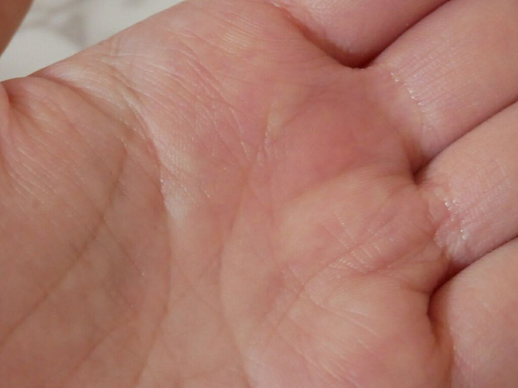 VC100エッセンスローション EX/ドクターシーラボⓇ/化粧水を使ったクチコミ（2枚目）