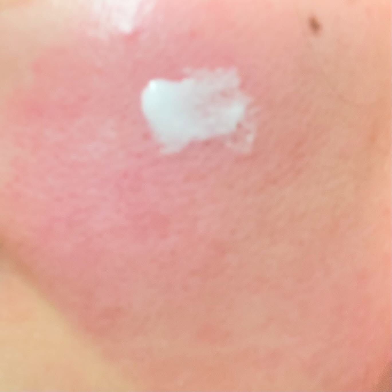 シカルファットプラス リペアミルク/アベンヌ/乳液を使ったクチコミ(3枚目)