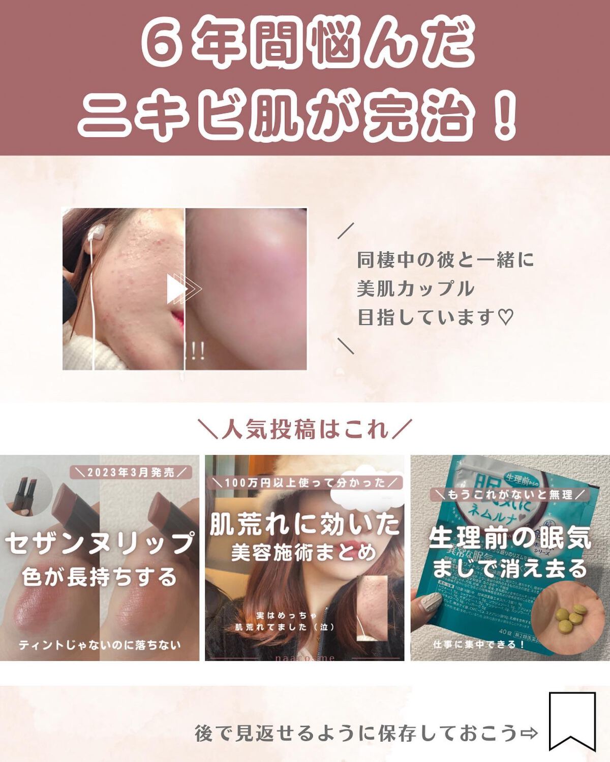 ニキビあとケアジェル/アットノン/その他スキンケアを使ったクチコミ(7枚目)