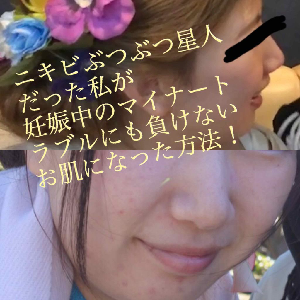 ニベアクリーム/ニベア/ボディクリームを使ったクチコミ(1枚目)