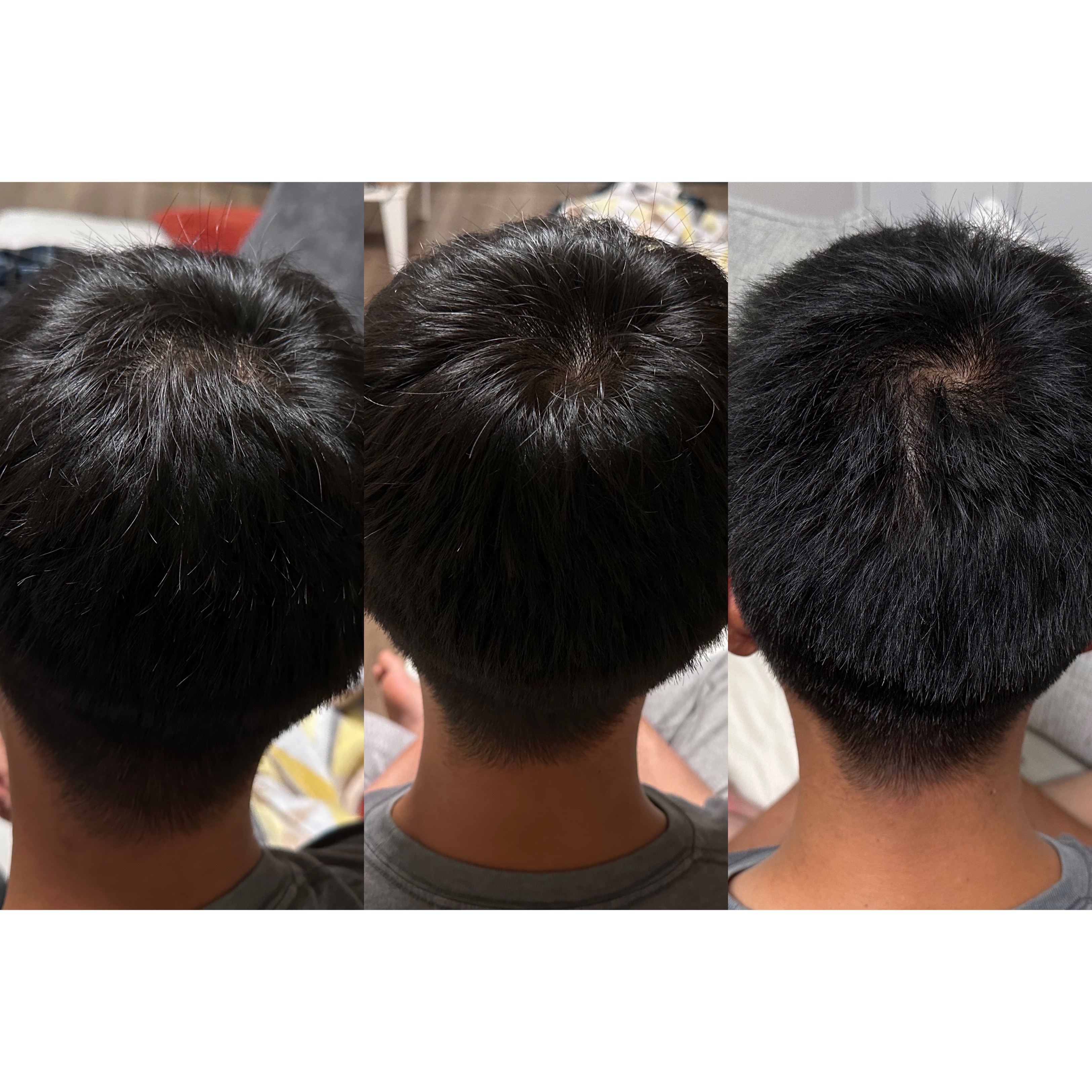 SonoRepro/アンファー(スカルプD)/ヘアケアグッズを使ったクチコミ（3枚目）