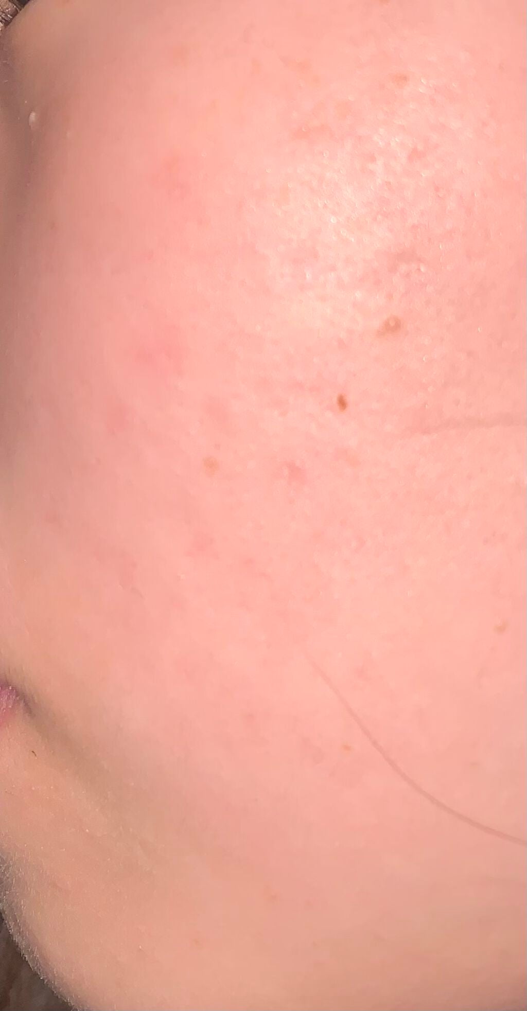 AHA·BHA·PHA 30デイズミラクルトナー/SOME BY MI/化粧水を使ったクチコミ(1枚目)