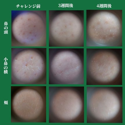 CICA クリーム/VT/フェイスクリームを使ったクチコミ(8枚目)