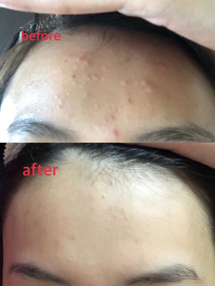 エッセンスマスク (ビタミンC)/クリアターン/シートマスク・パックを使ったクチコミ(2枚目)