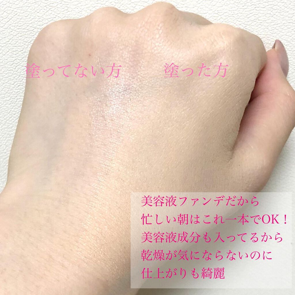 Wエッセンス/shimaboshi/美容液を使ったクチコミ（2枚目）