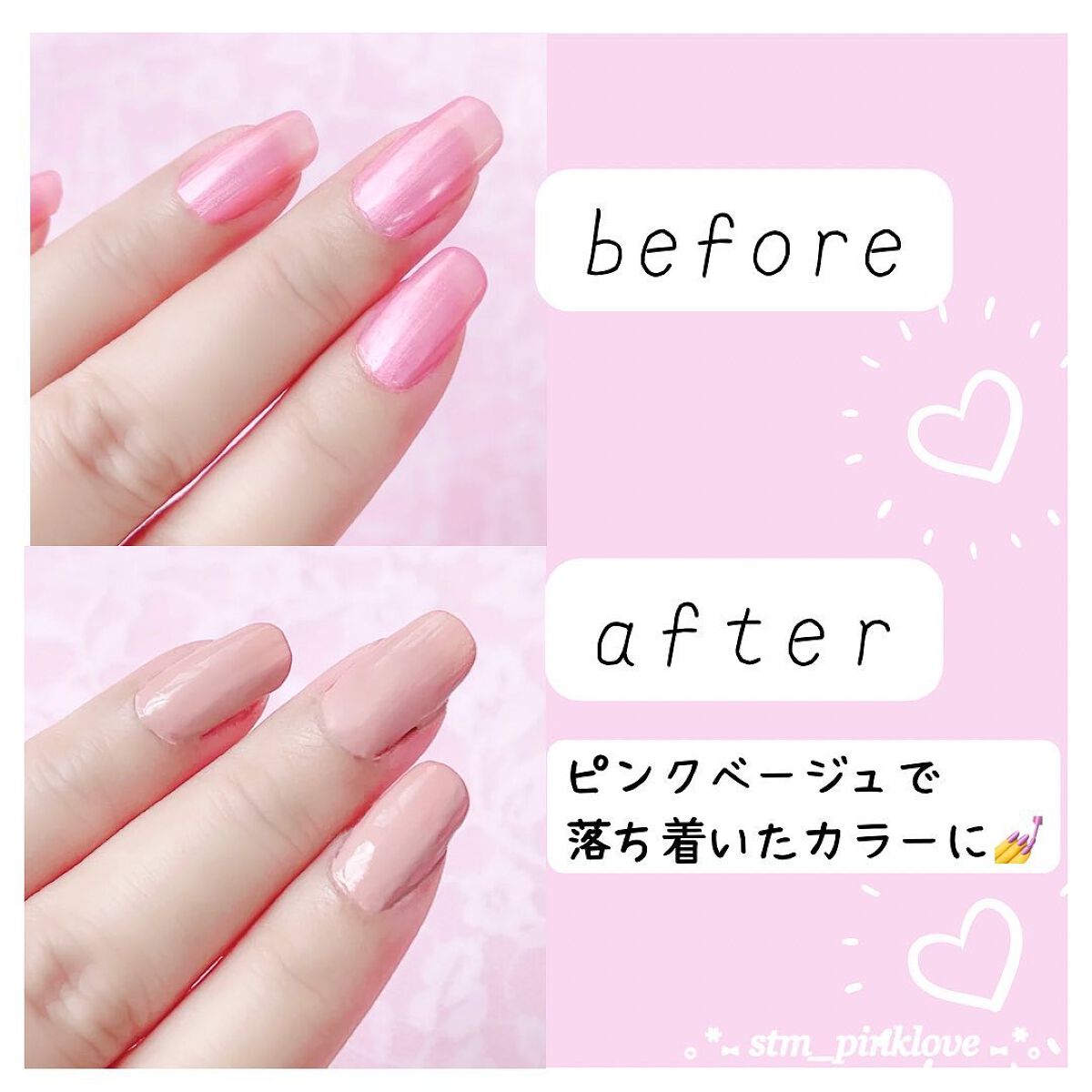 1Dayネイル隠し/DAILY NAILLY/ネイル用品を使ったクチコミ(5枚目)