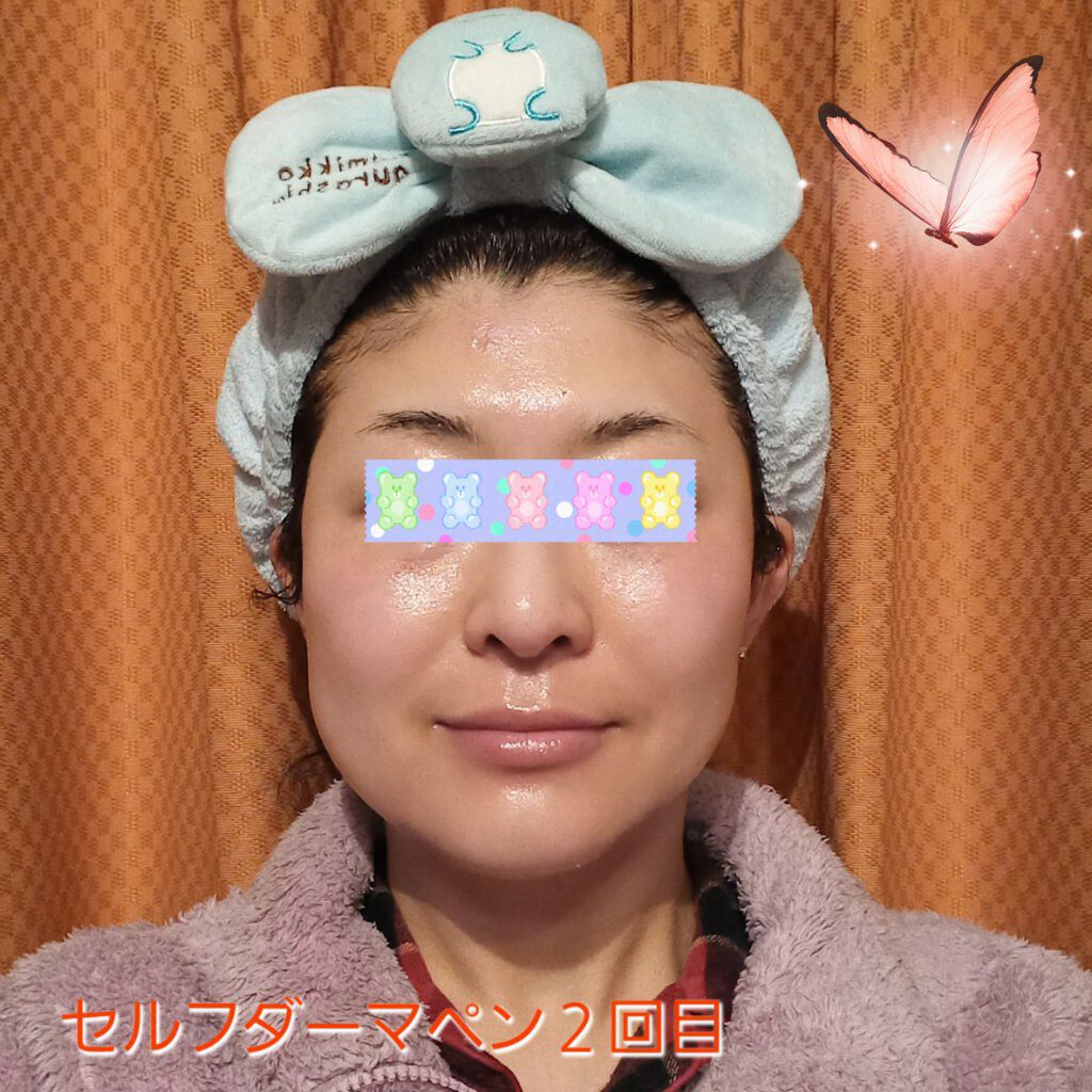 ステムセルフセラム/KISO/美容液を使ったクチコミ（1枚目）