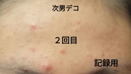 ナチュラルパック /MIRANAL/洗い流すパック・マスクを使ったクチコミ(3枚目)