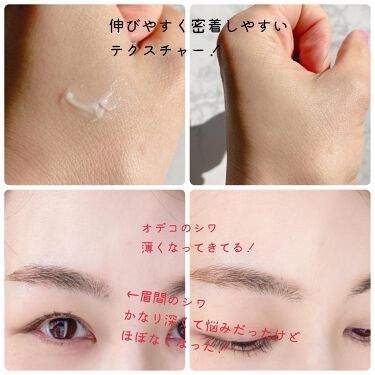 限定アイケア アイクリーム リンクルショット メディカル セラム リンクルショットの効果に関する口コミ シワ改善のパイオニアは裏切らない 1 1 By 怪盗ち 敏感肌 30代後半 Lips