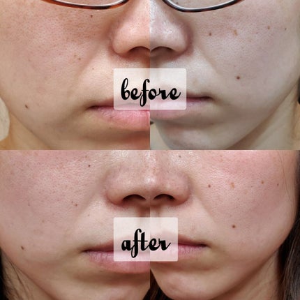 プロバイオダーム リフティング クリーム/BIOHEAL BOH/フェイスクリームを使ったクチコミ(9枚目)