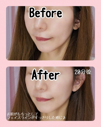 あやたんぬ🎀フォロバ100👌 on LIPS 「【提供/MEDITHERAPY】大人になるにつれ気になるお肌の..」(6枚目)