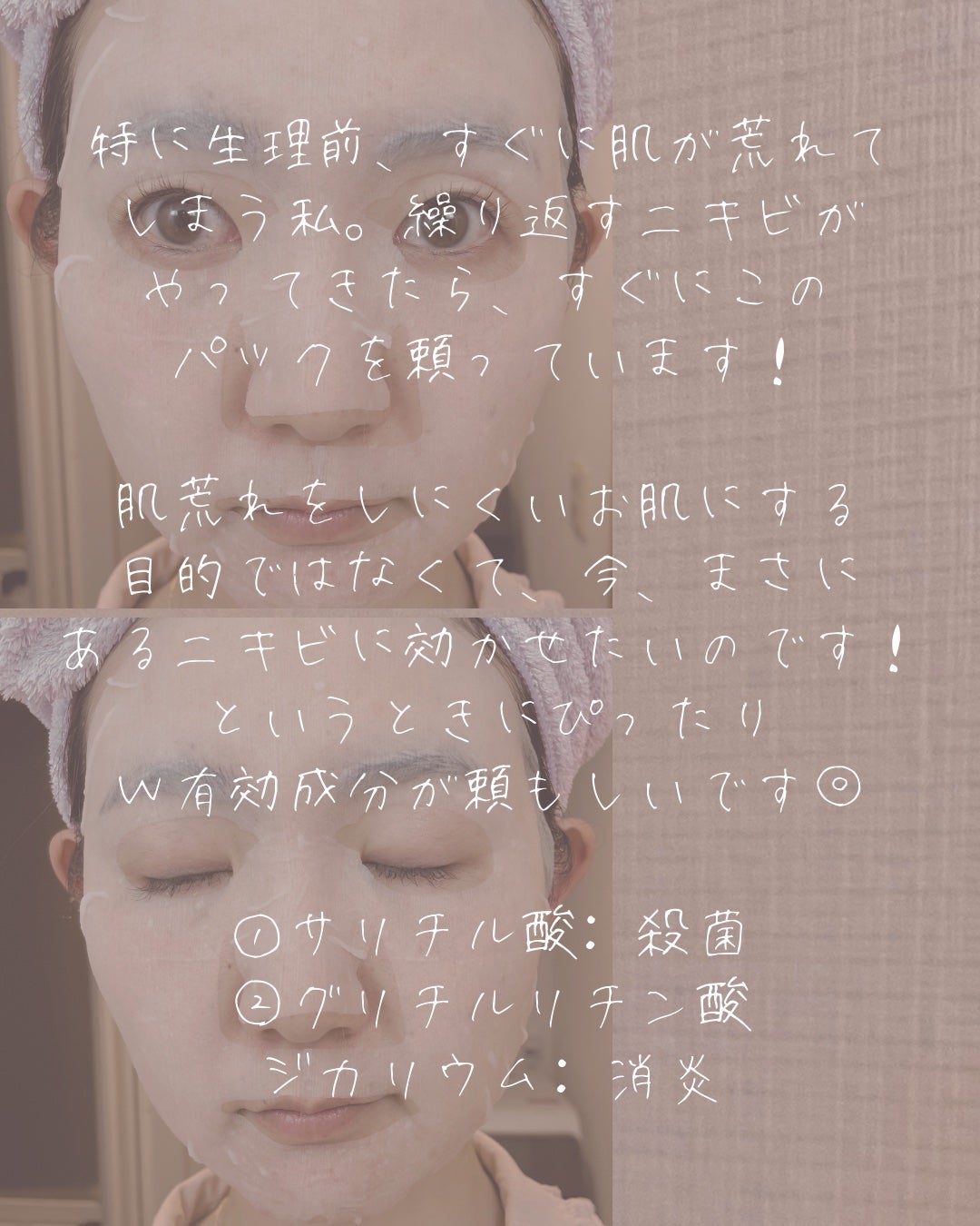 ごめんね素肌 キニナルマスク/クリアターン/シートマスク・パックを使ったクチコミ(4枚目)