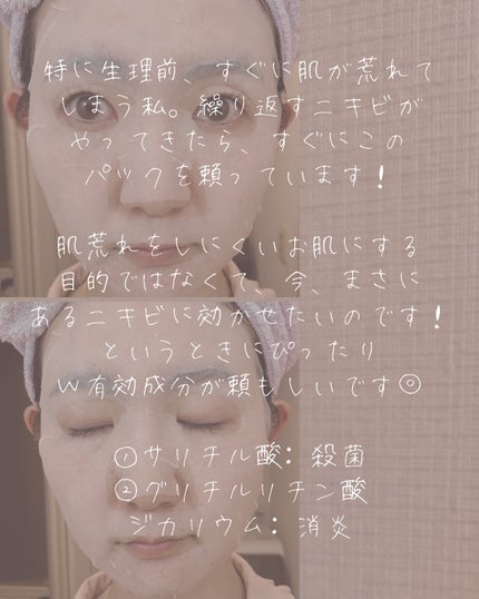 ごめんね素肌 キニナルマスク/クリアターン/シートマスク・パックを使ったクチコミ(4枚目)