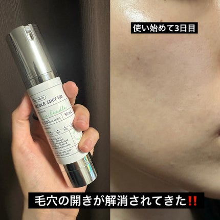 リードルショット100/VT/美容液を使ったクチコミ(3枚目)