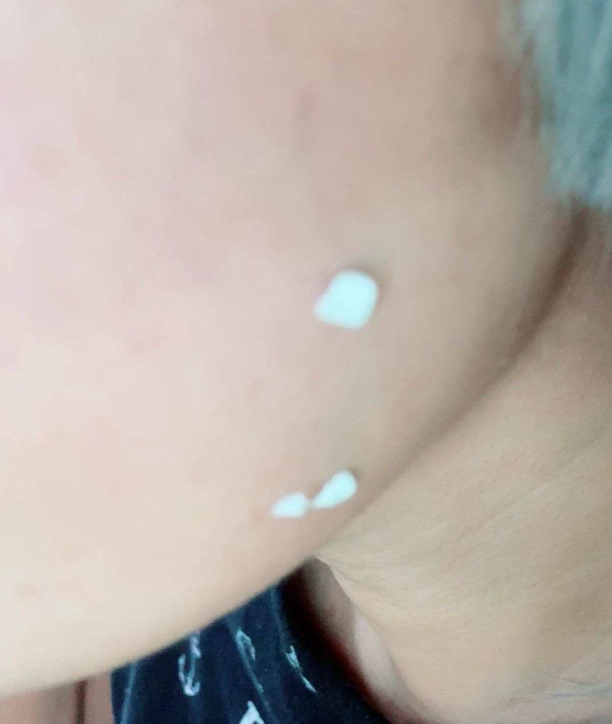 ミラクルアクネクリアスポットトリートメント/SOME BY MI/美容液を使ったクチコミ（3枚目）