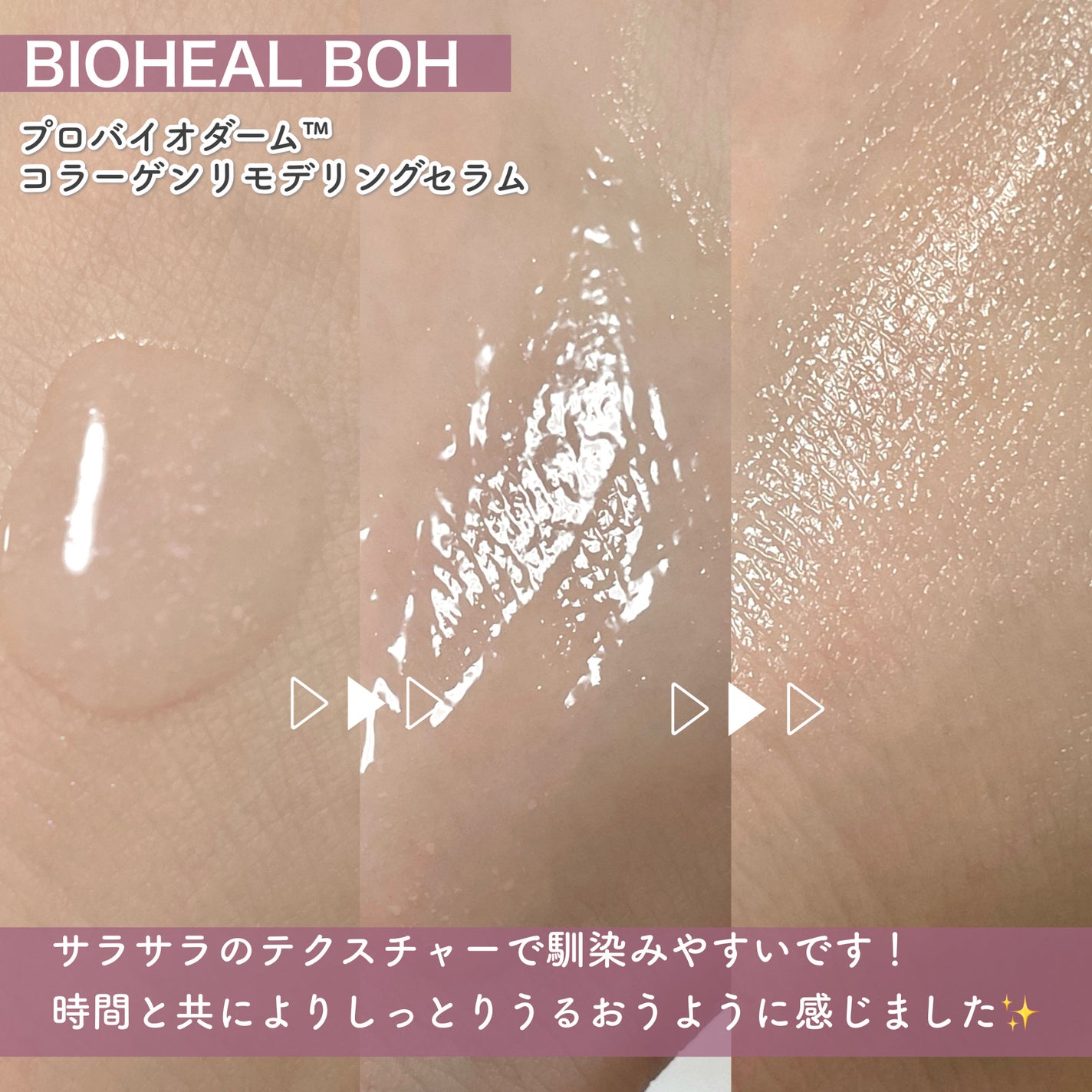 バイオヒールボ プロバイオダーム 3Dリフティングクリーム/BIOHEAL BOH/フェイスクリームを使ったクチコミ(4枚目)