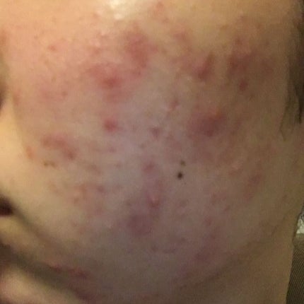 デュオ ザ クレンジングバーム/DUO/クレンジングバームを使ったクチコミ(3枚目)