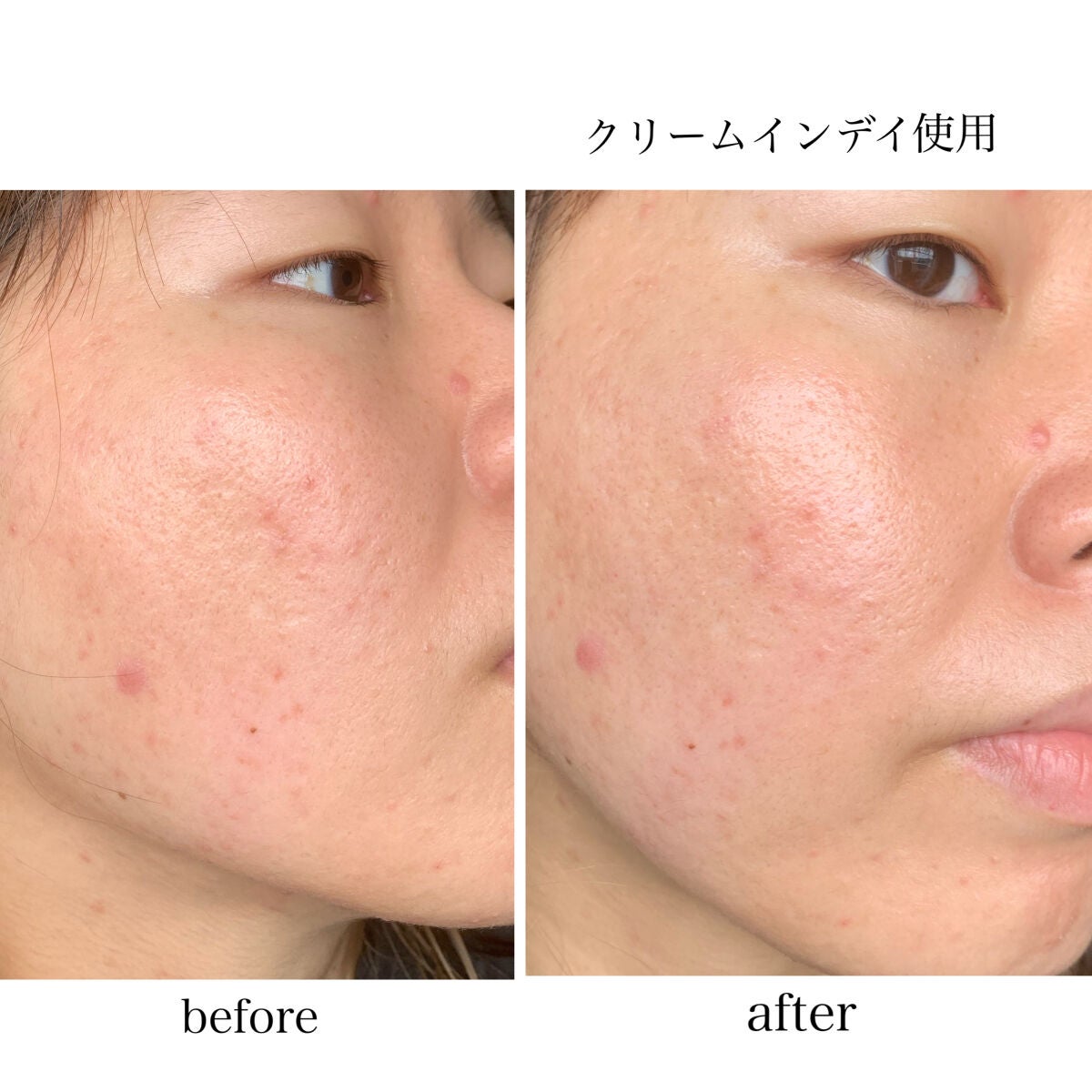 クリーム イン デイ/KANEBO/フェイスクリームを使ったクチコミ(8枚目)