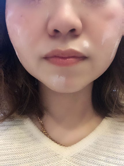 トラブルペアーマスク/DEWYCEL/シートマスク・パックを使ったクチコミ(2枚目)