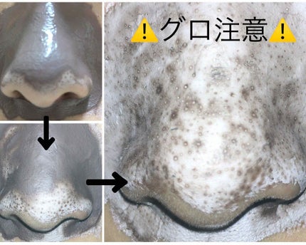 ツルリ 皮脂吸い出し 部分用パック ガスール&レッドパワー/ツルリ/洗い流すパック・マスクを使ったクチコミ(3枚目)