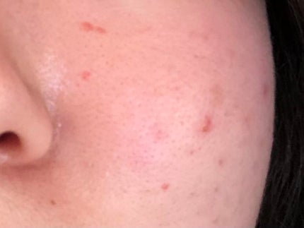 を使ったクチコミ(2枚目)