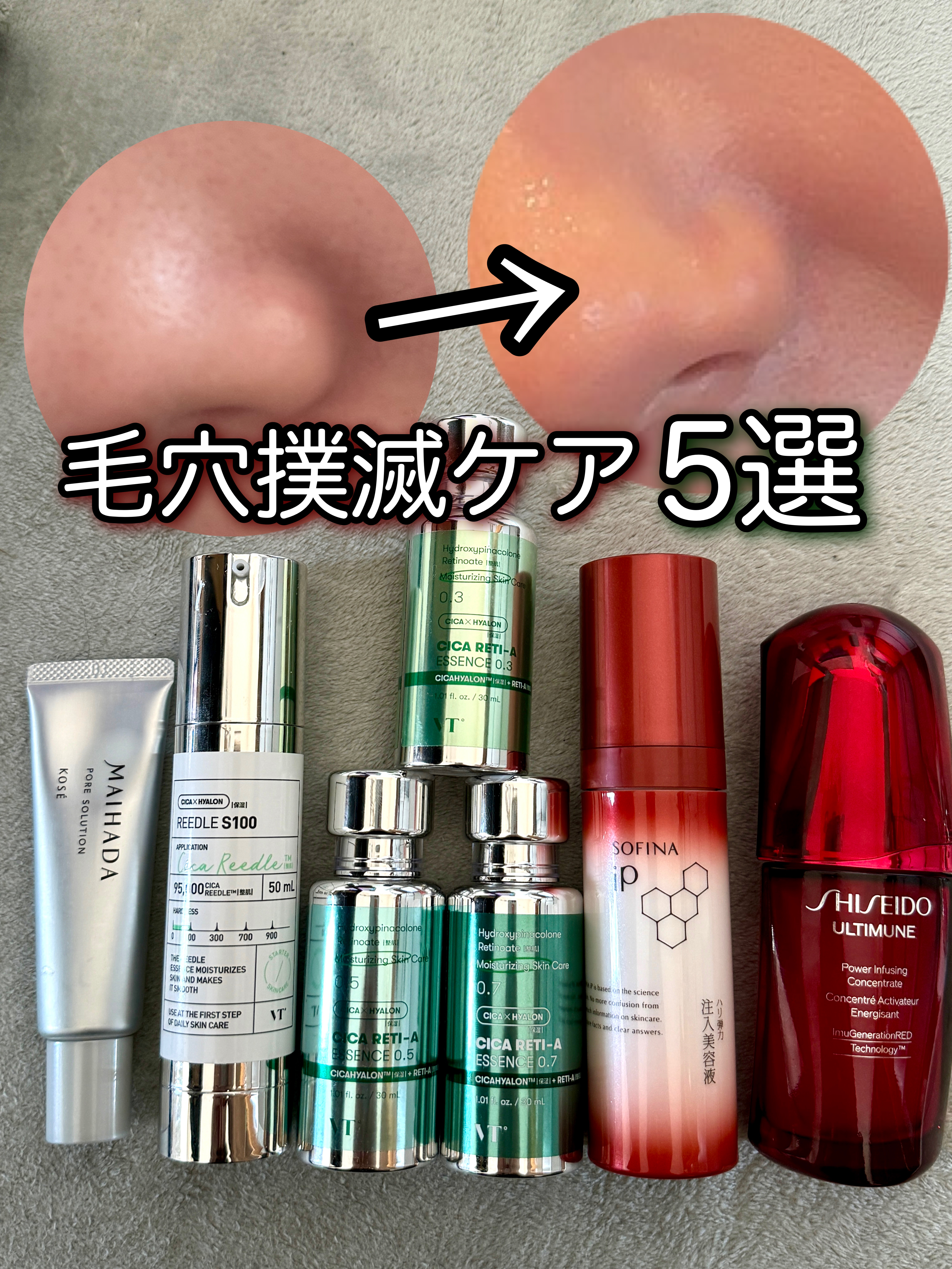 シカレチA エッセンス0.7/VT/美容液を使ったクチコミ（1枚目）