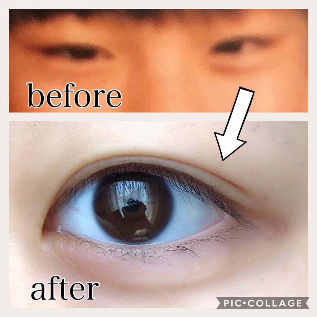 のび〜る アイテープ 両面テープタイプ/DAISO/二重まぶた用アイテムを使ったクチコミ(1枚目)