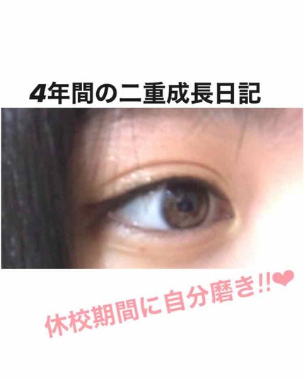 肌色タイプ/バンドエイド/その他を使ったクチコミ(1枚目)