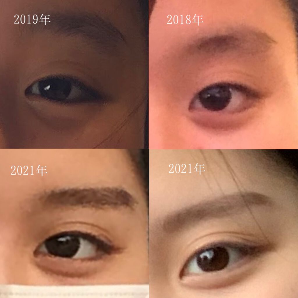 お鼻リフォーマー ハナハナ/グッズマン/その他を使ったクチコミ（2枚目）